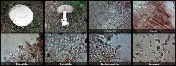 Microscopía de Amanita ovoidea