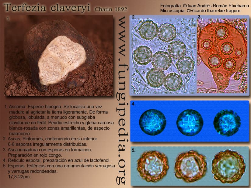 Microscopía de Terfezia claveryi