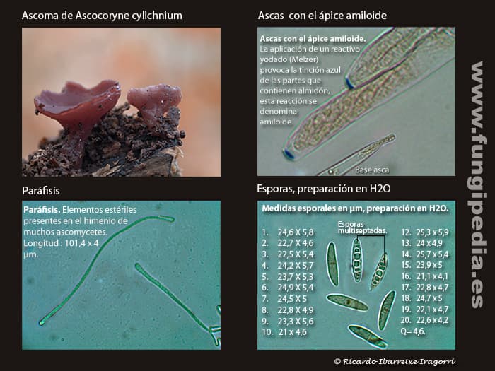 Microscopía de Ascocoryne cylichnium