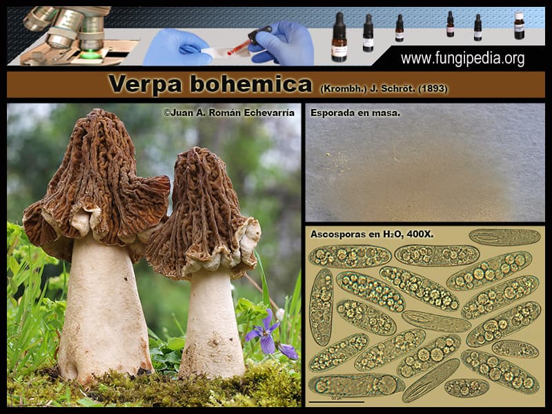 Microscopía de Verpa bohemica