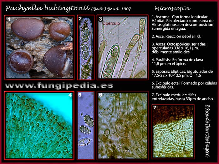 Microscopía de Adelphella babingtonii = Pachyella babingtonii