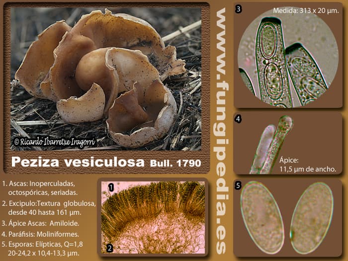 Microscopía de Peziza vesiculosa
