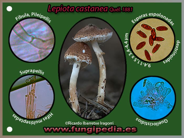 Microscopía de Lepiota castanea