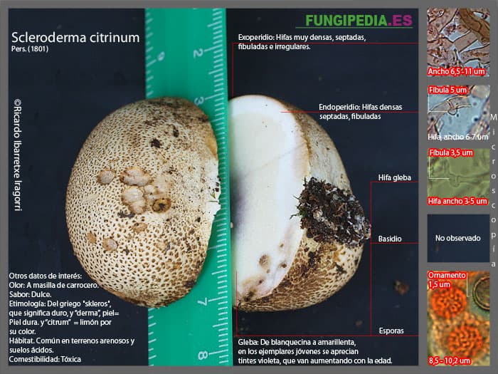 Microscopía de Scleroderma citrinum