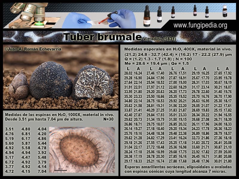 Microscopía de Tuber brumale