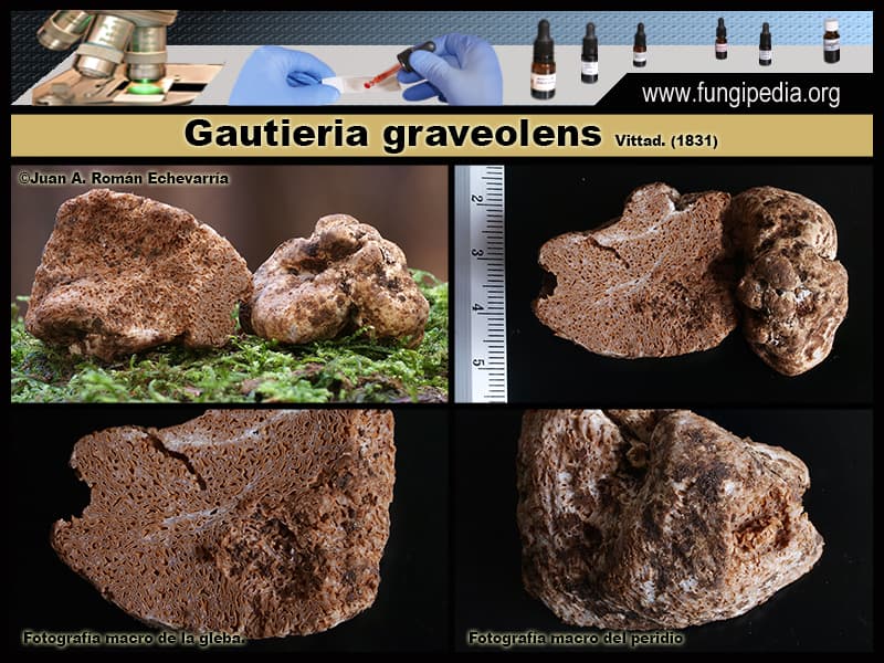 Microscopía de Gautieria graveolens.