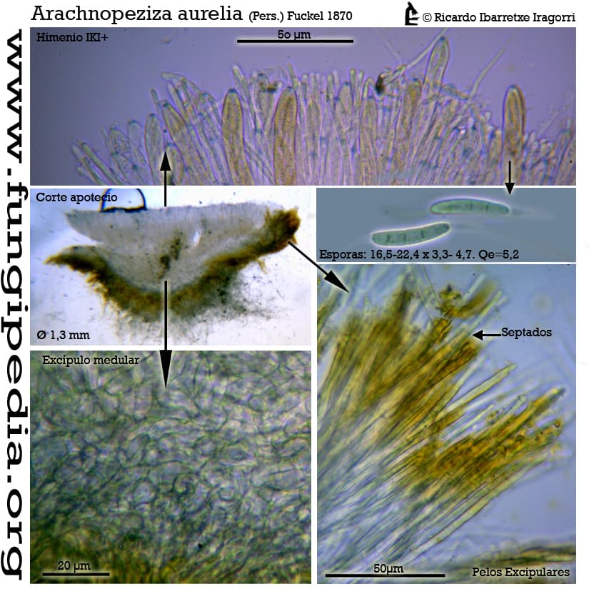 Microscopía de Arachnopeziza aurelia