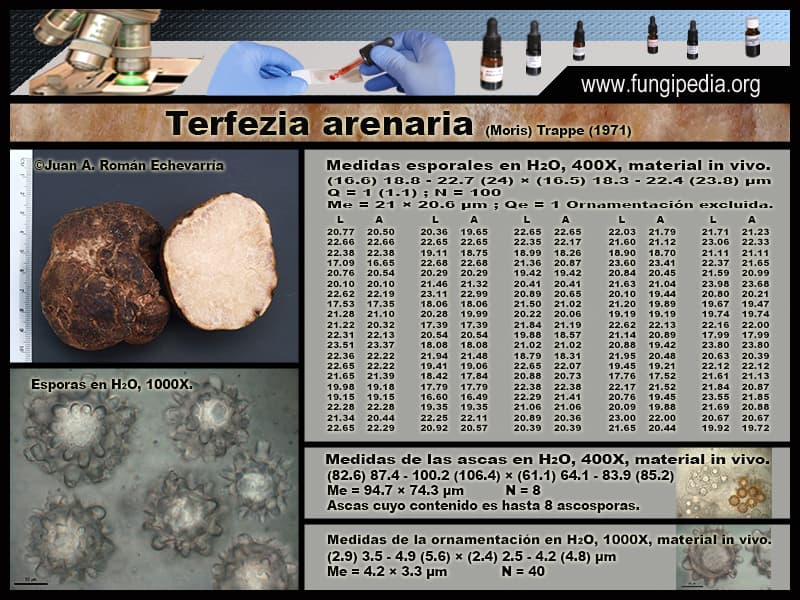 Microscopía de Terfezia arenaria