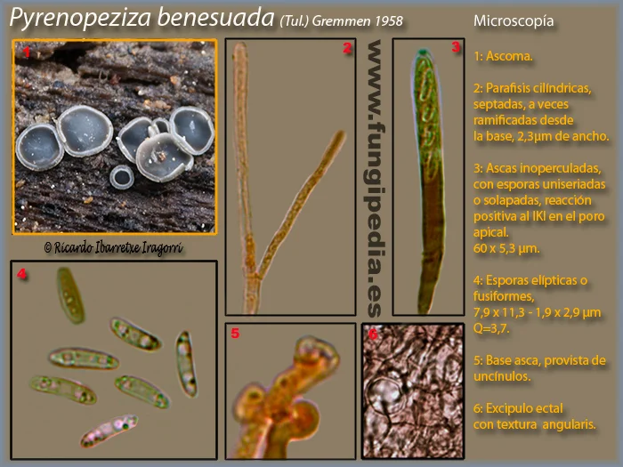 Microscopía de Pyrenopeziza benesuada