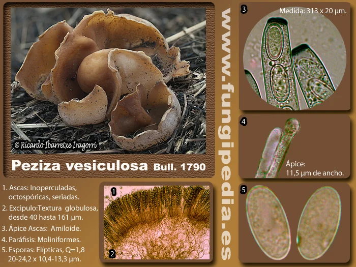 Microscopía de Peziza vesiculosa