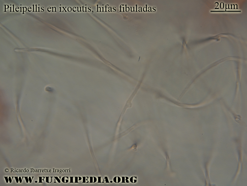 Microscopía de Hebeloma birrus Pileipellis