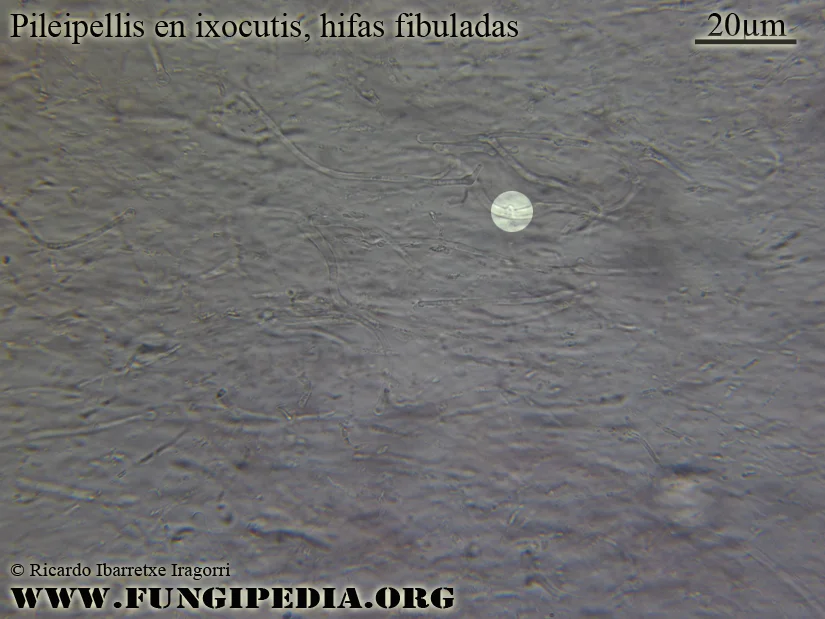 Microscopía de Stropharia inuncta