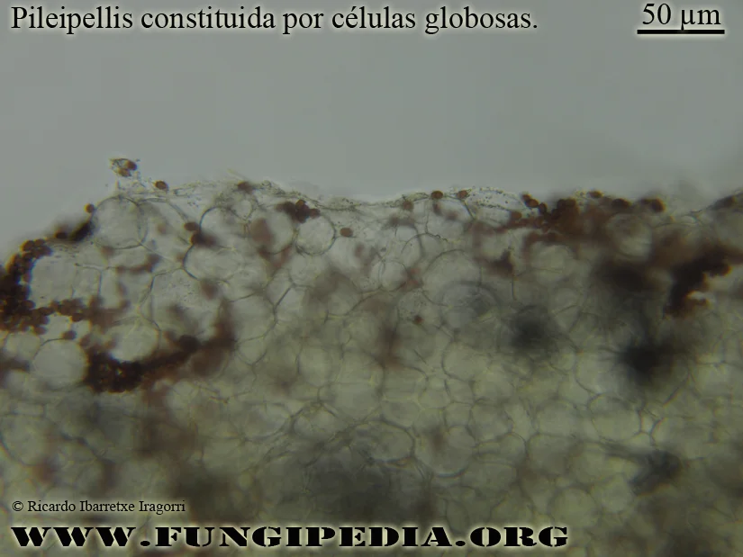 Microscopía de Typhrasa gossypina