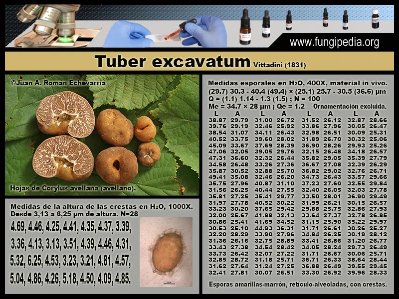 Microscopía de Tuber excavatum