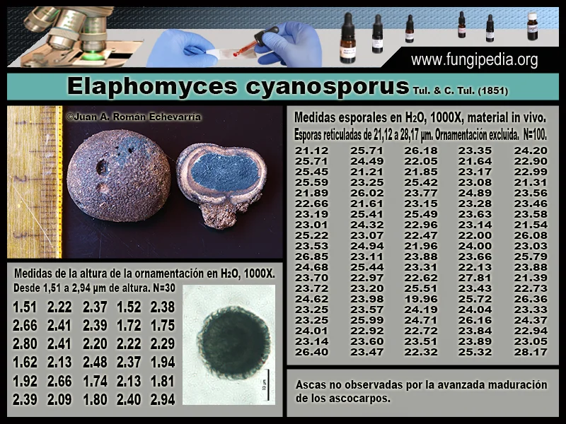 Microscopía de Elaphomyces cyanosporus