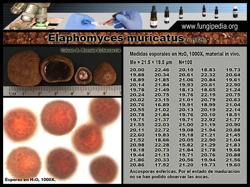 Microscopía de Elaphomyces muricatus