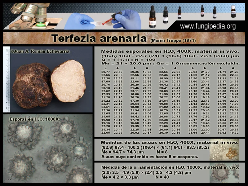Microscopía de Terfezia arenaria