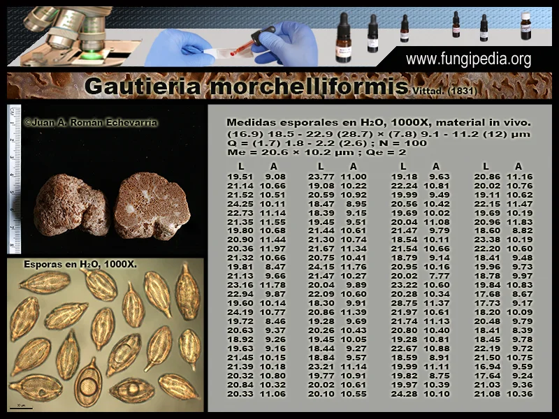 Microscopía de Gautieria morchelliformis