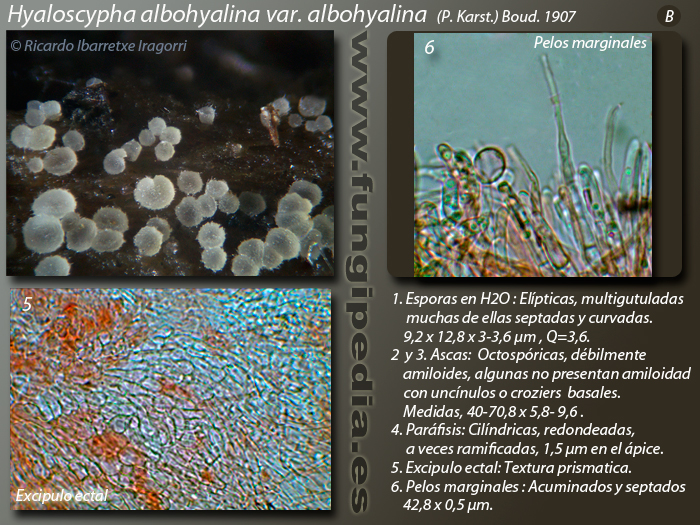 Hyaloscypha-albohyalina-var_albohyalina_B.jpg