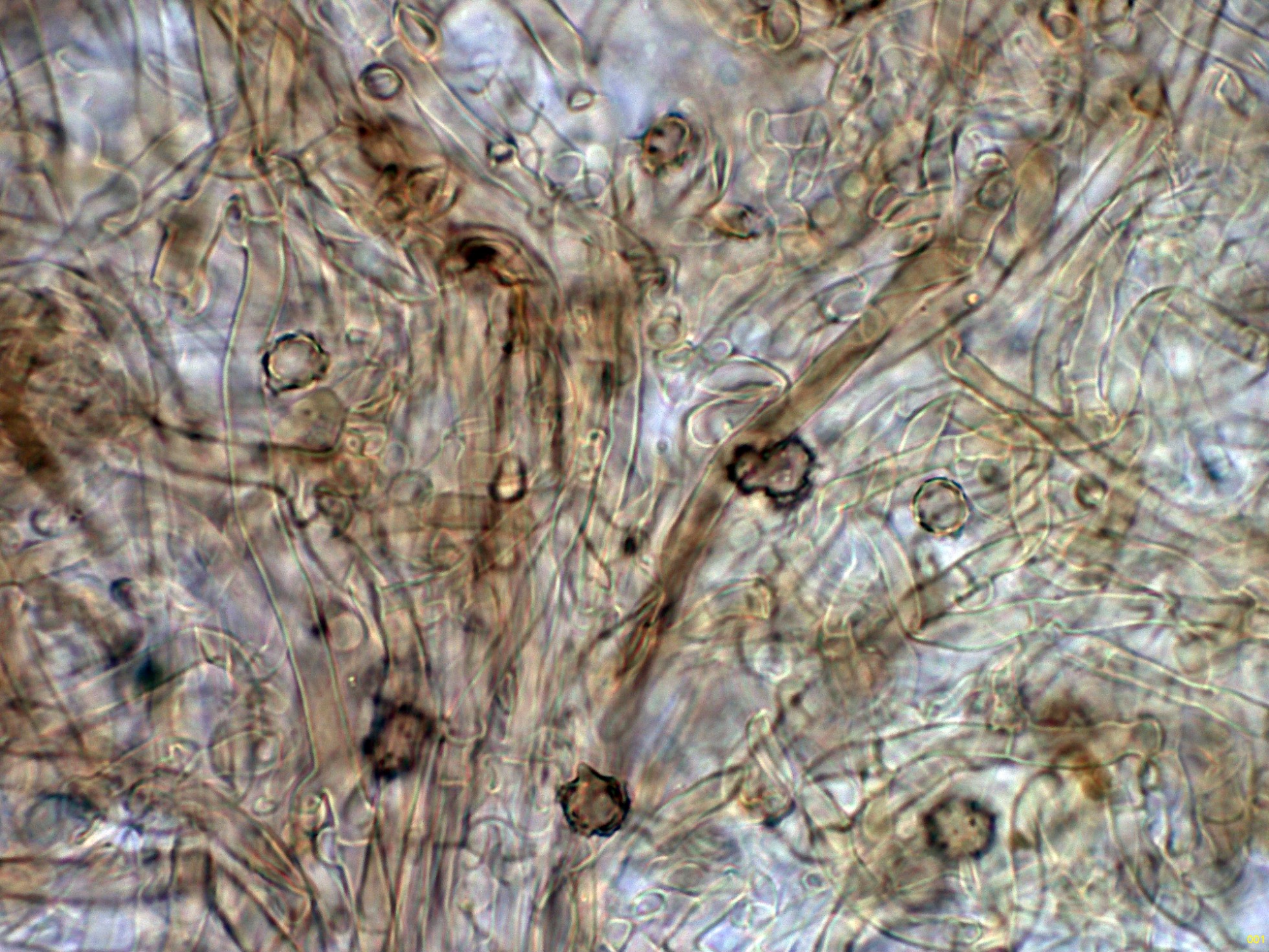 10-HifassubicularesMelzer-001_2025-10-25.jpg