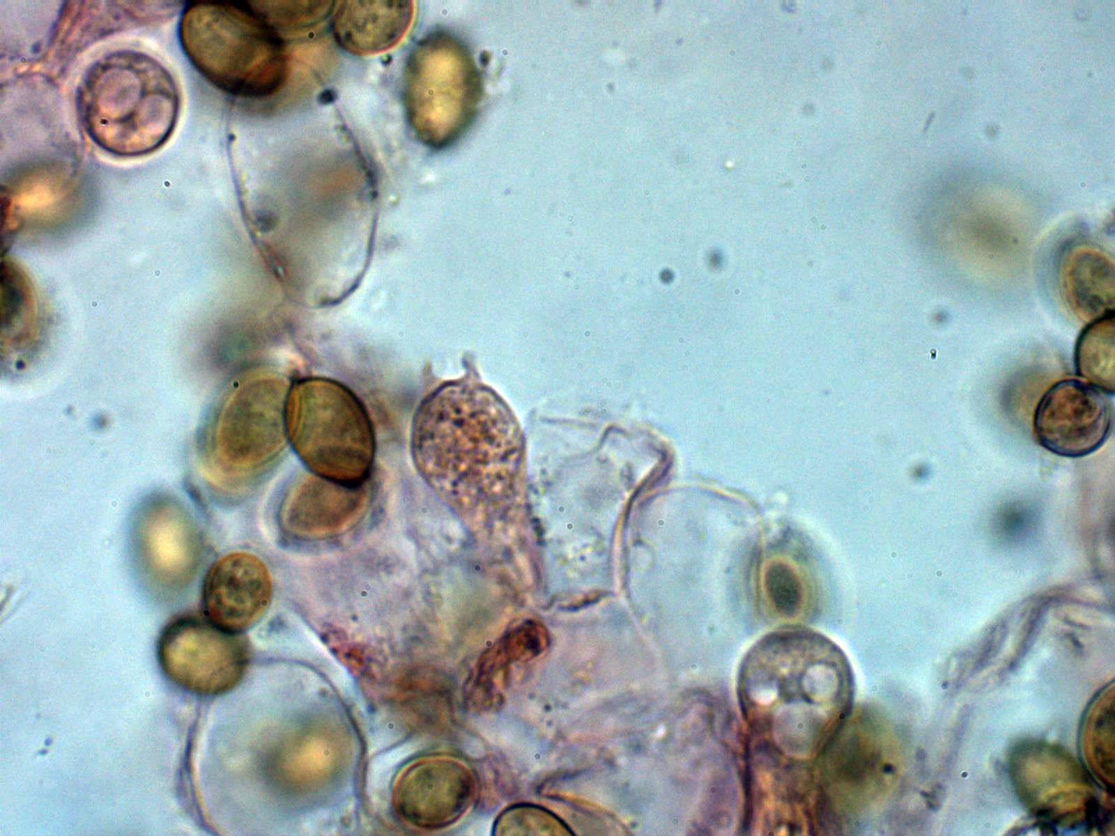 16-Basidiobisporico.jpg
