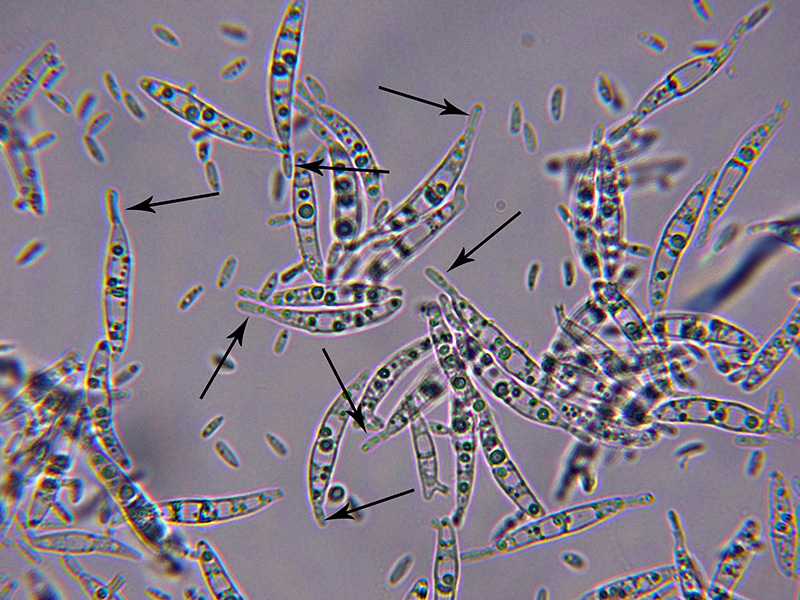 17-Microsporas.jpg