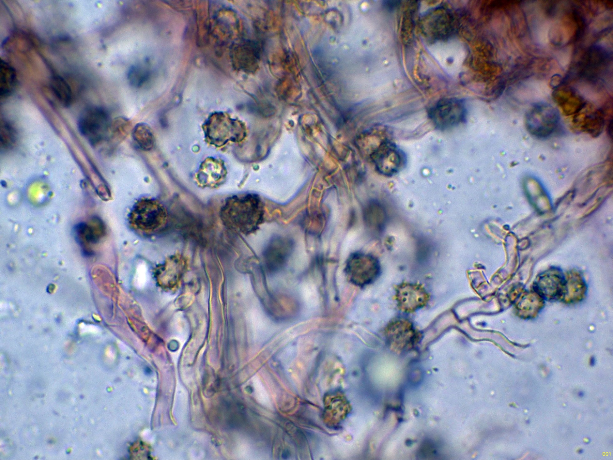 8-Hifassubiculares-001_2025-10-25.jpg