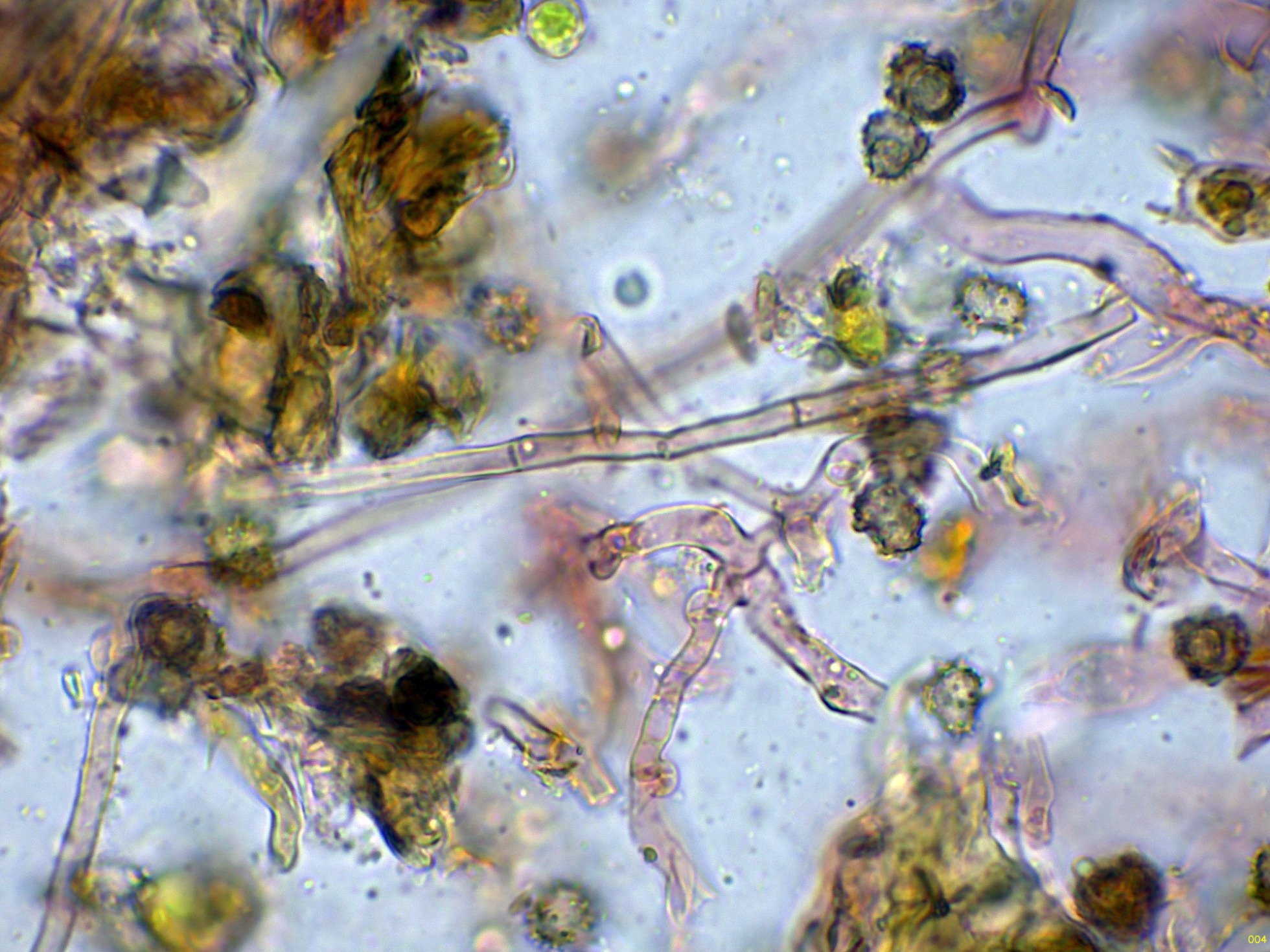 9-Hifassubiculares-004_2025-10-25.jpg