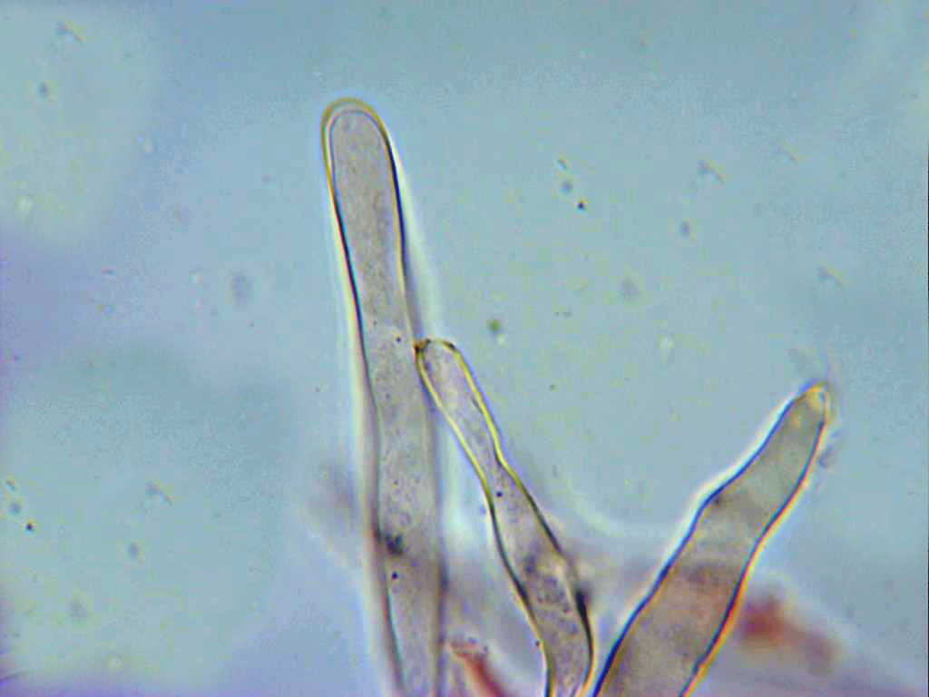 9-Pileocistidios.jpg
