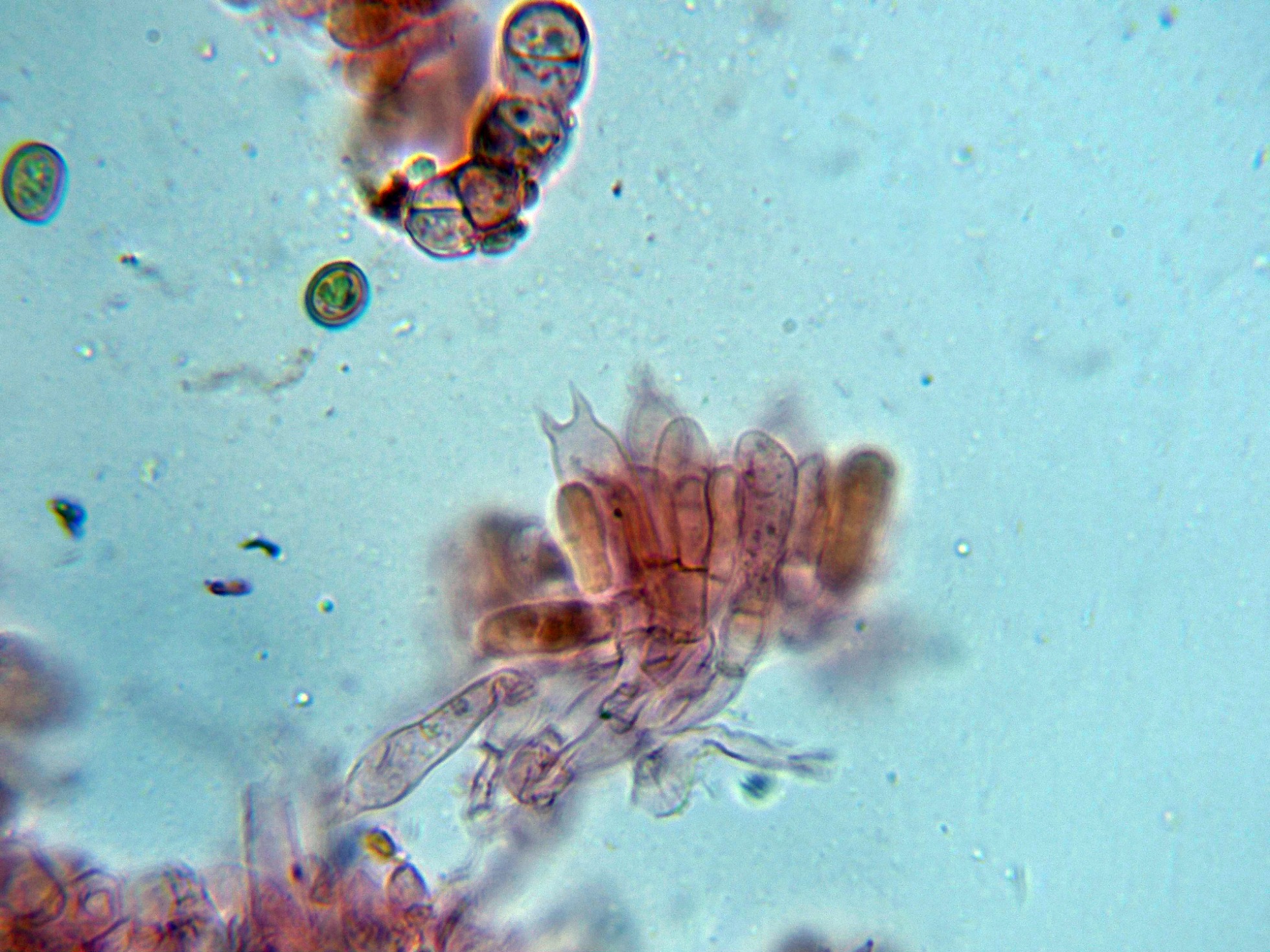 Basidiobisporico-004.jpg