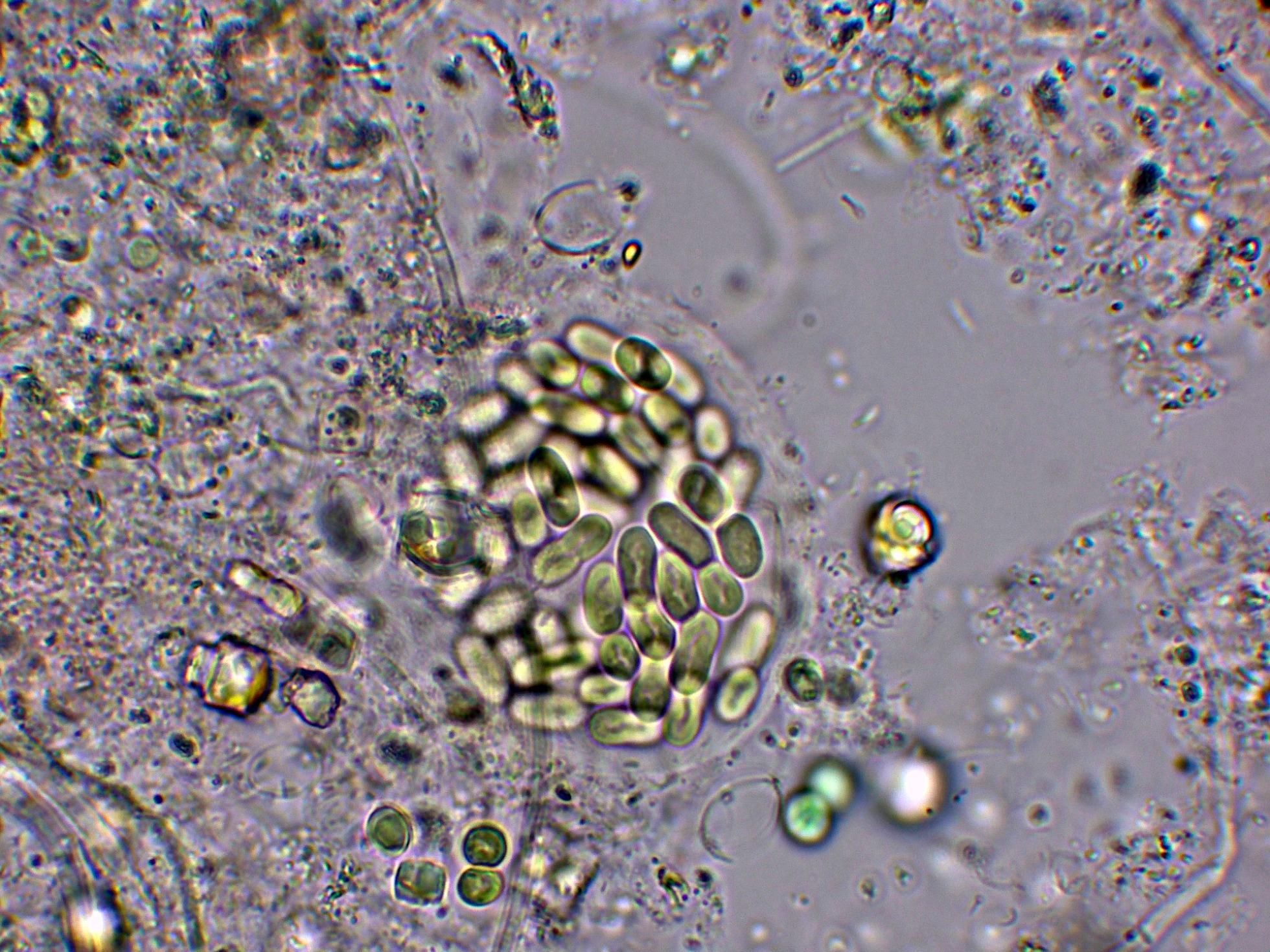 Cianobacterias-002.jpg