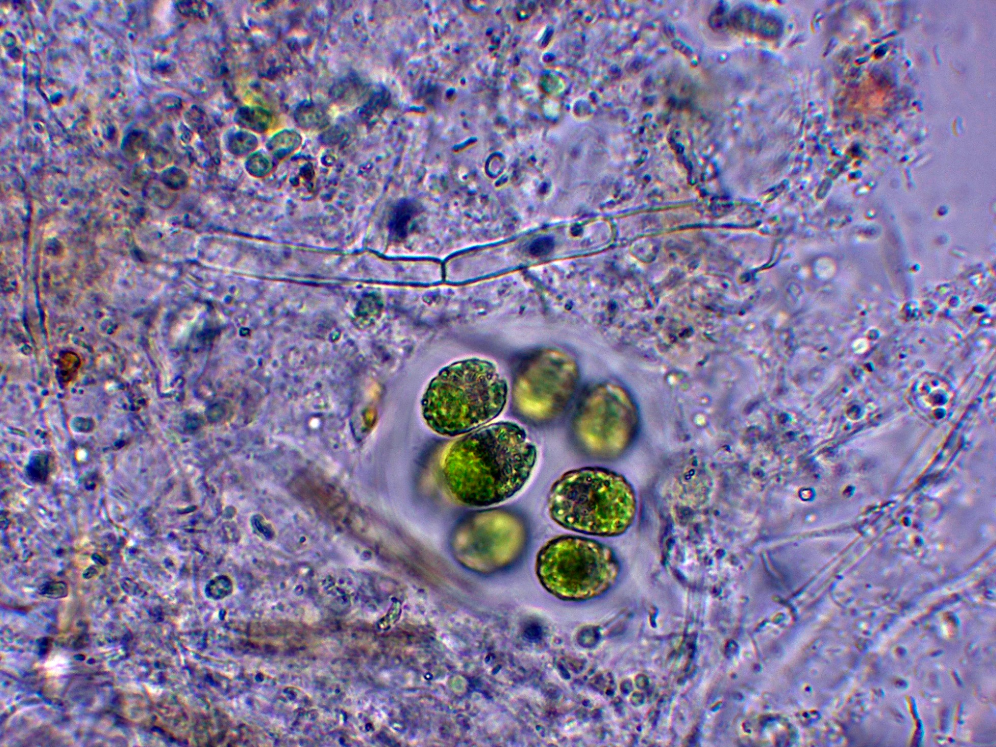 Cianobacterias-003.jpg
