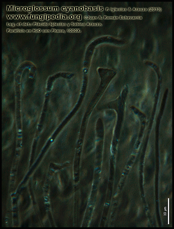21-3Microglossum_cyanobasis_Parafisis_Microscopy_Microscopia.jpg