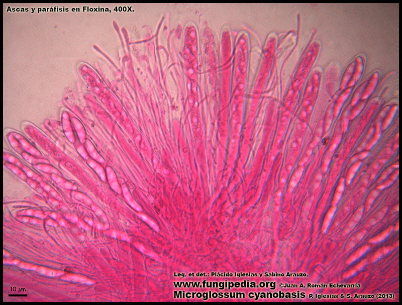 28Microglossum_cyanobasis_Himenio_Microscopy_Microscopia.jpg