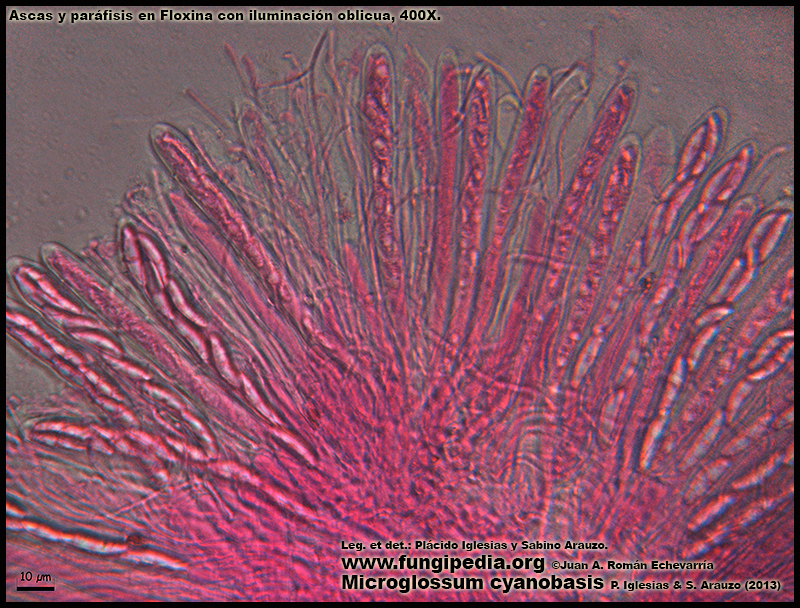 29Microglossum_cyanobasis_Himenio_Microscopy_Microscopia.jpg