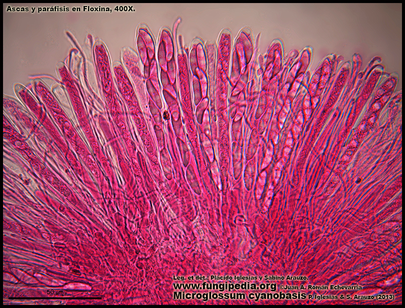31Microglossum_cyanobasis_Himenio_Microscopy_Microscopia.jpg
