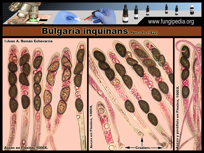 7Bulgaria_inquinans_Microscopia_Microscopy_2020-03-25.jpg