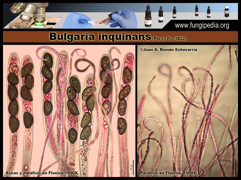 8-1Bulgaria_inquinans_Microscopia_Microscopy_2020-03-25.jpg