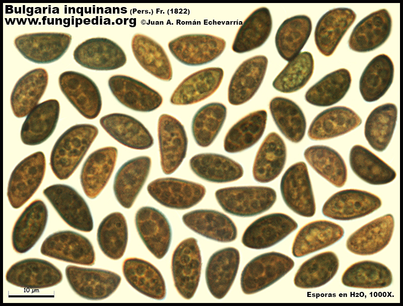 9-1Bulgaria_inquinans_Microscopia_Microscopy.jpg