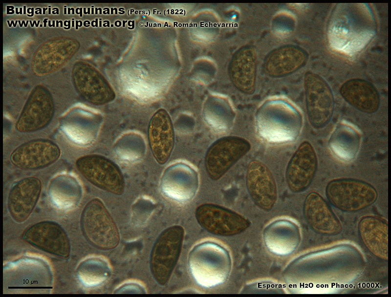 9-2Bulgaria_inquinans_Microscopia_Microscopy.jpg