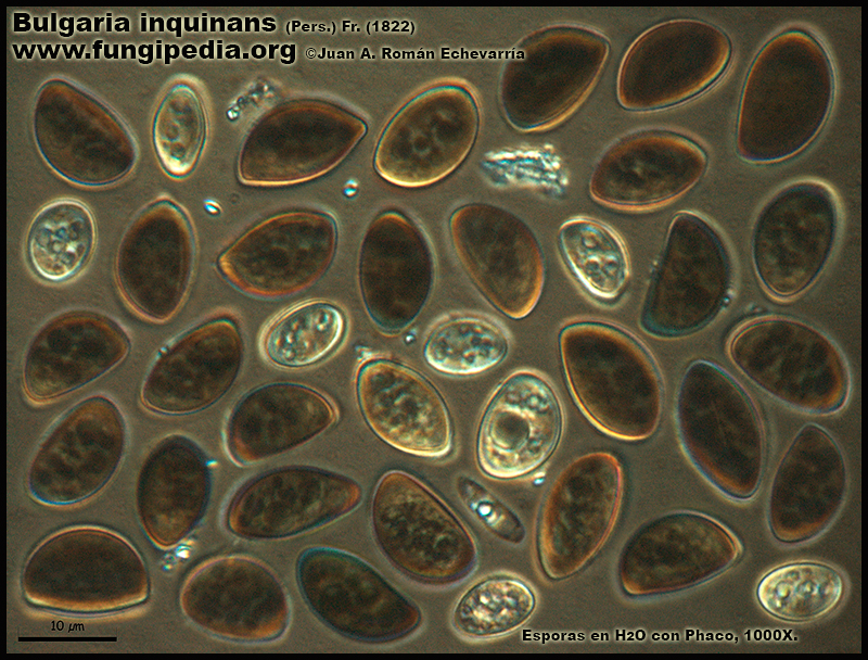 9-3Bulgaria_inquinans_Microscopia_Microscopy.jpg