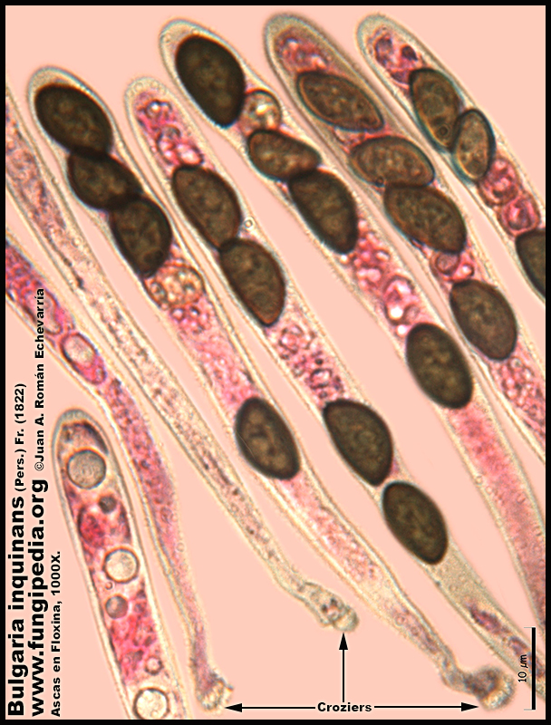 9-7Bulgaria_inquinans_Microscopia_Microscopy.jpg