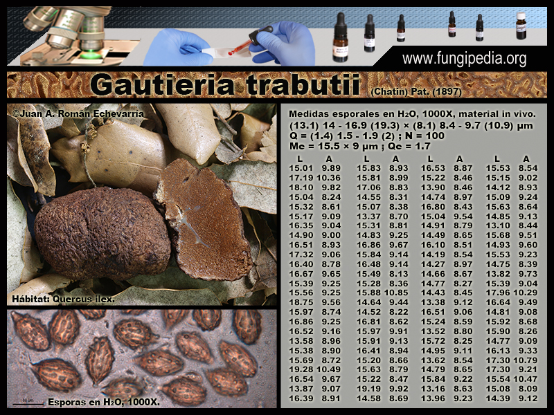 Gautieria_trabutii_Microscopia_Microscopy1-2.jpg