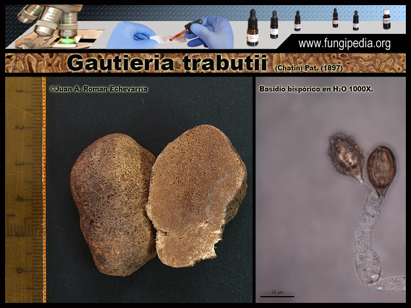 Gautieria_trabutii_Microscopia_Microscopy1-3.jpg