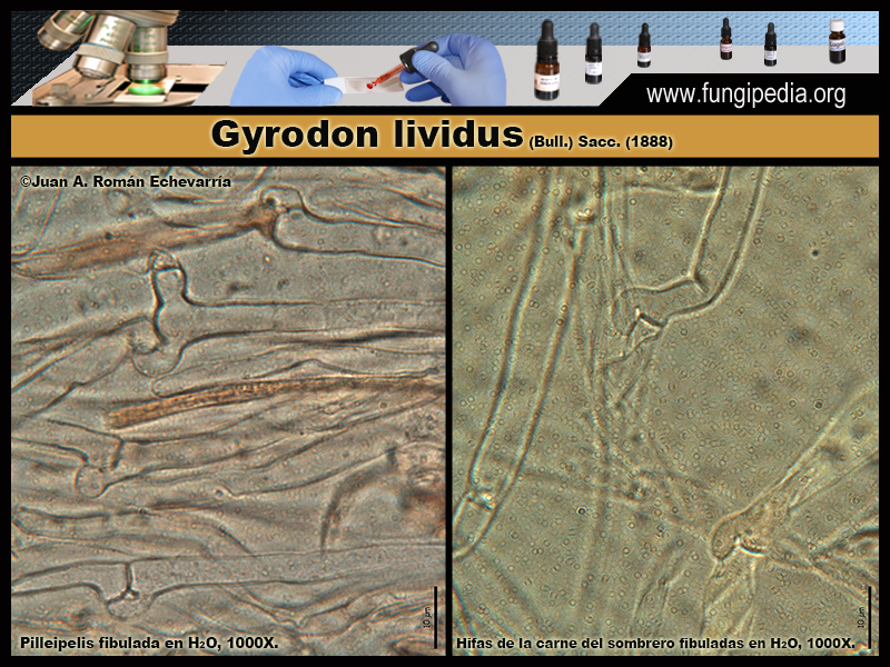 Gyrodon_lividus_Microscopia_Microscopy3.jpg
