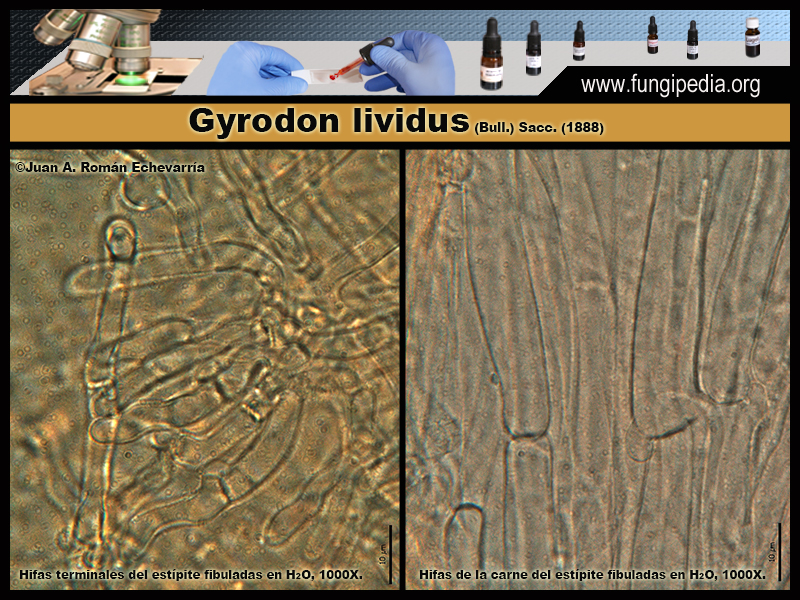 Gyrodon_lividus_Microscopia_Microscopy4.jpg