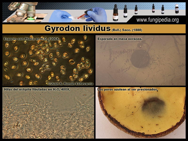 Gyrodon_lividus_Microscopia_Microscopy5.jpg