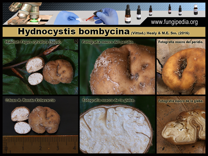Hydnocystis_bombycina_Microscopia_Microscopy1-2.jpg