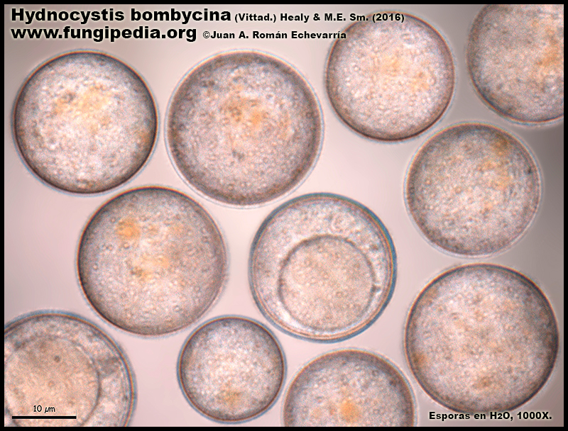 Hydnocystis_bombycina_Microscopia_Microscopy2-2.jpg