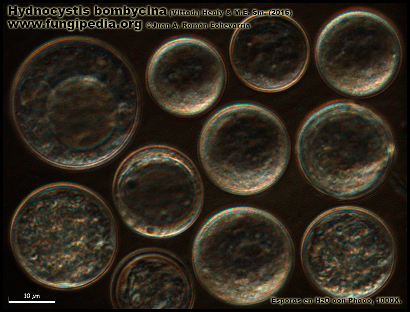 Hydnocystis_bombycina_Microscopia_Microscopy2-7.jpg